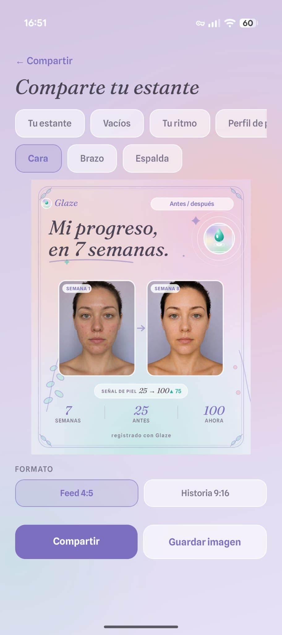 Comparar